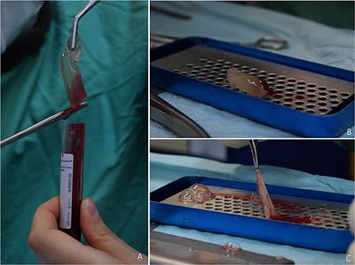 Production Protocol Standardisation, Macroscopic and Histological Evaluation, and Growth Factor Quantification of Canine Leukocyte-and Platelet-Rich Fibrin Membranes